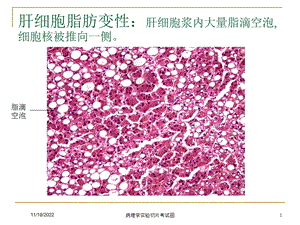 病理学实验切片考试图培训课件.ppt