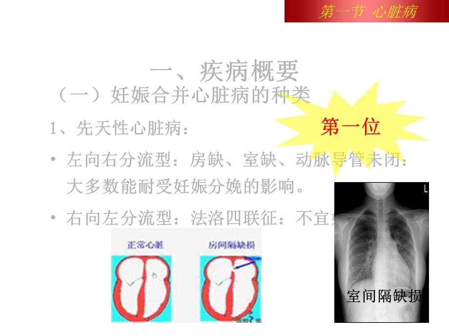 妊娠合并心脏病患者的护理课件.pptx_第3页