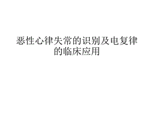 恶性心律失常的识别医学课件.ppt