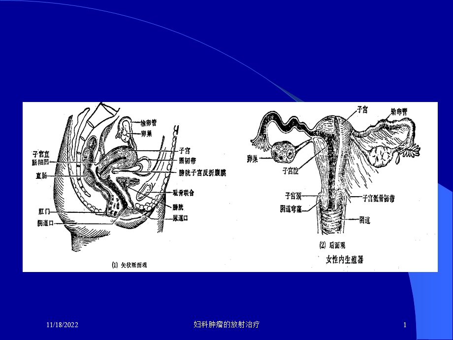 妇科肿瘤的放射治疗课件.ppt_第1页