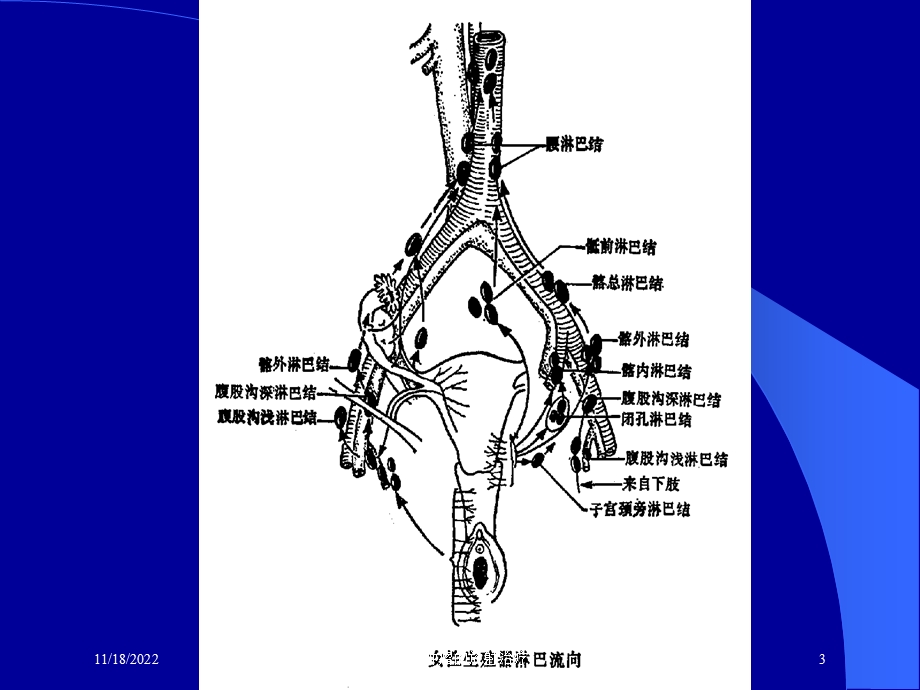 妇科肿瘤的放射治疗课件.ppt_第3页