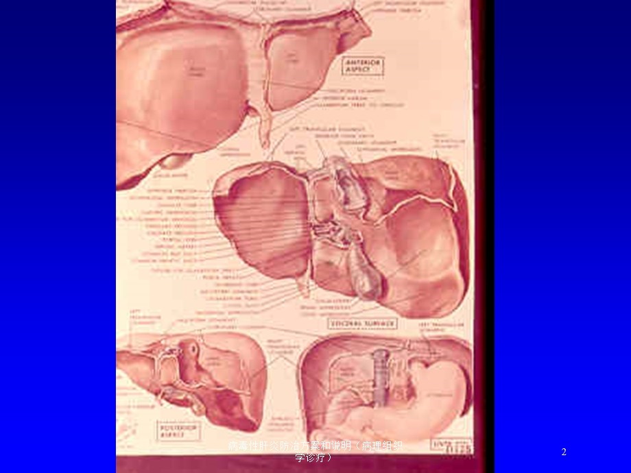 病毒性肝炎防治方案和说明(病理组织学诊疗)培训课件.ppt_第2页