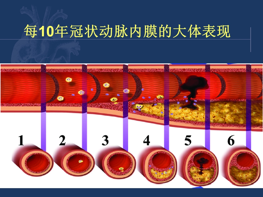 冠状动脉粥样硬化性心脏病药物治疗ppt课件.ppt_第2页