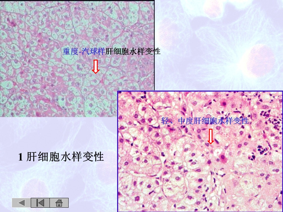 病理切片图例课件.ppt_第3页