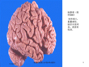 病理实验并茂X考试图片培训课件.ppt