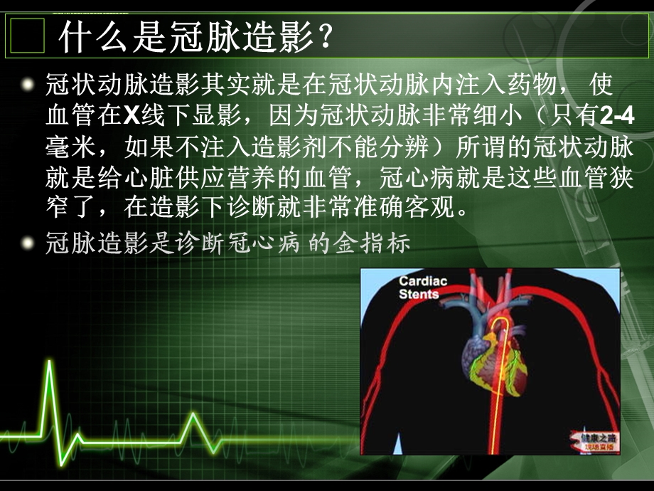 冠脉造影健康宣教ppt课件.ppt_第2页