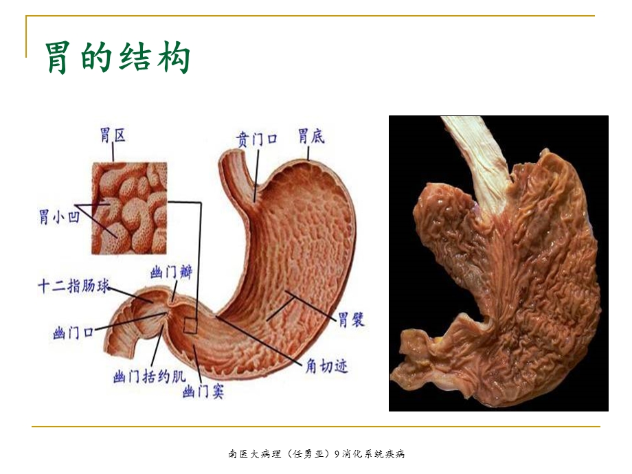 病理消化系统疾病课件.ppt_第2页