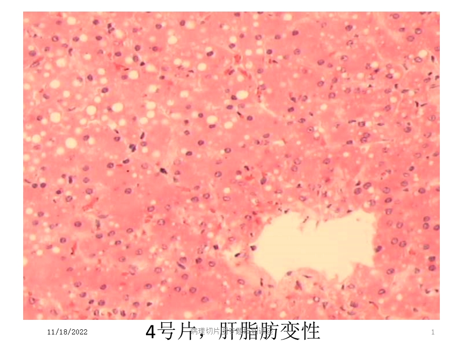 病理切片图专题培训讲座培训课件.ppt_第1页