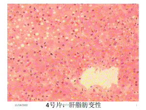 病理切片图专题培训讲座培训课件.ppt