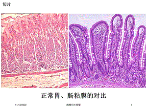 病理切片观察培训课件.ppt