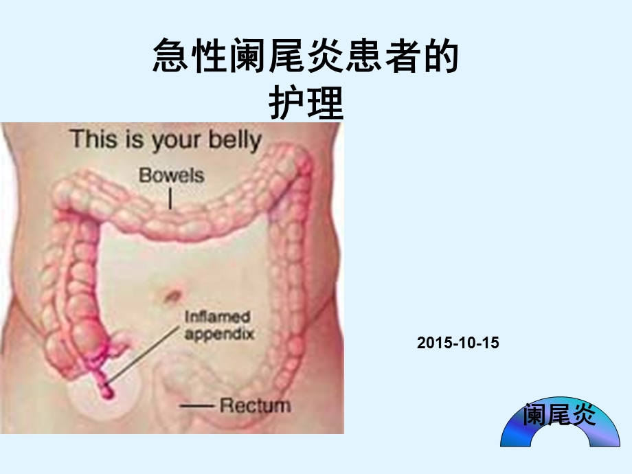 急性阑尾炎患者的护理课件.pptx_第1页