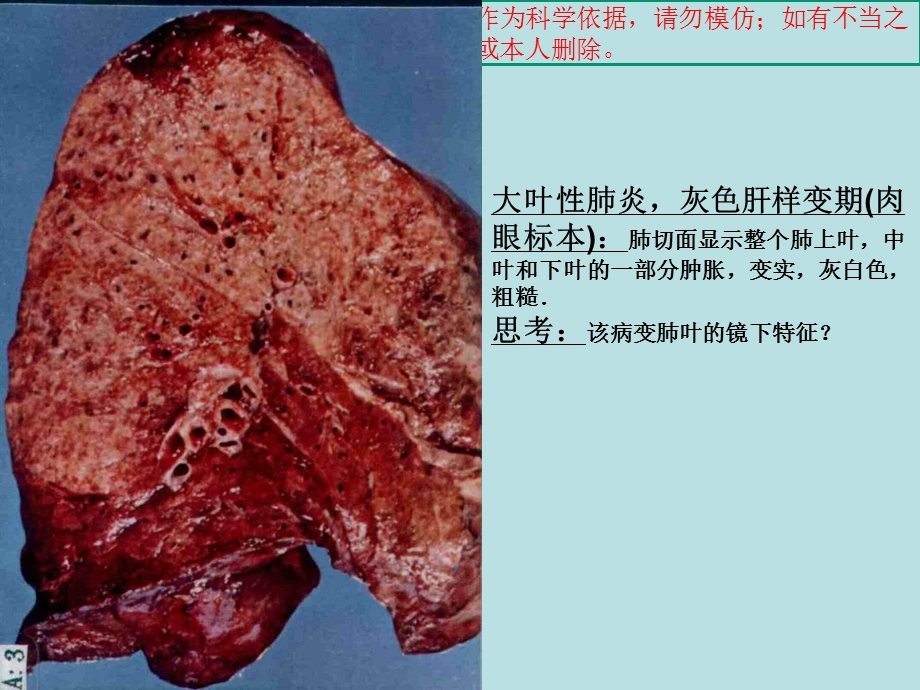 病理实验考试图片培训课件.ppt_第1页