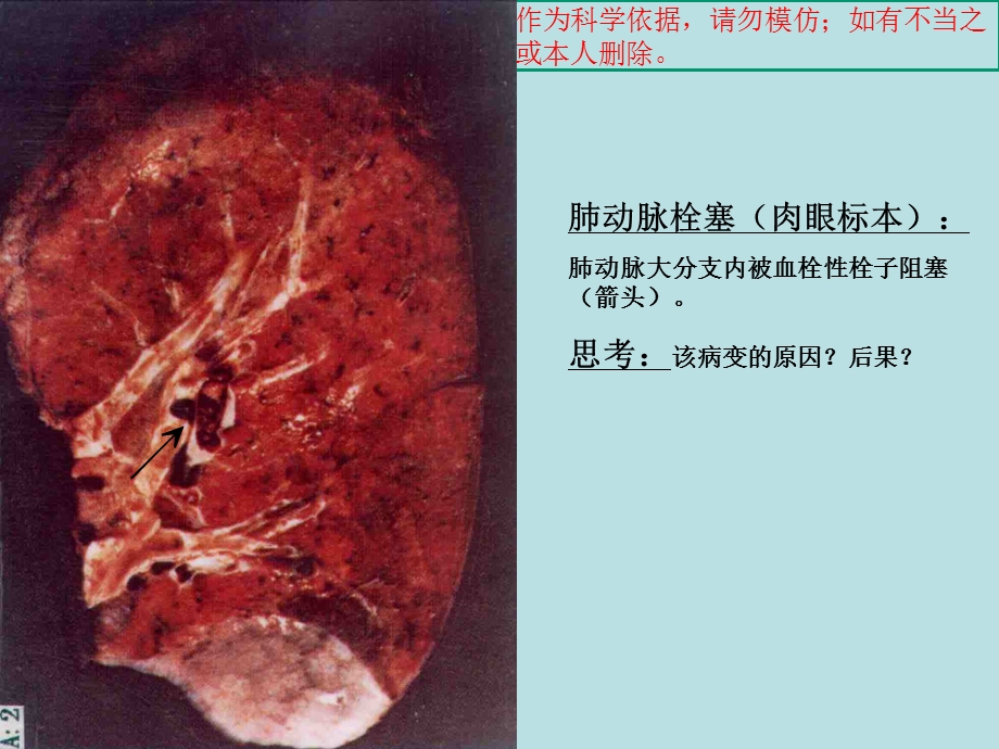 病理实验考试图片培训课件.ppt_第2页