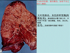 病理实验考试图片培训课件.ppt