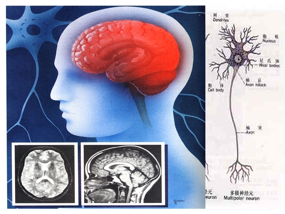 病理学：神经系统课件.ppt_第2页