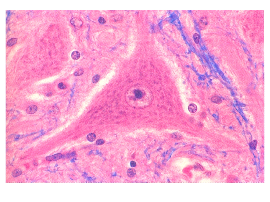 病理学：神经系统课件.ppt_第3页