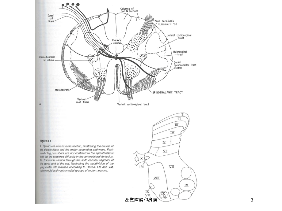 感觉障碍和瘫痪培训课件.ppt_第3页