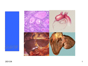 病理学课件第一章绪论讲义.ppt