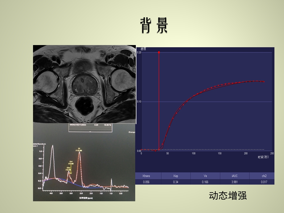 前列腺MR动态增强ppt课件.ppt_第2页