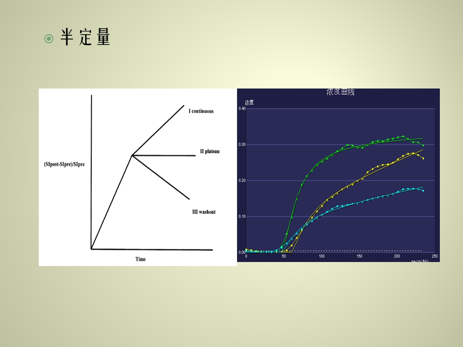 前列腺MR动态增强ppt课件.ppt_第3页