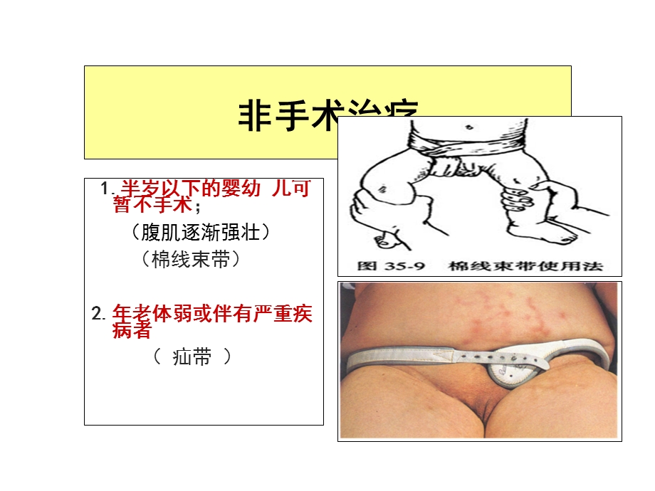 腹股沟疝手术课件.ppt_第2页