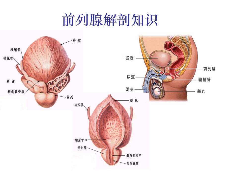 前列腺疾病与治疗原则ppt课件.ppt_第3页