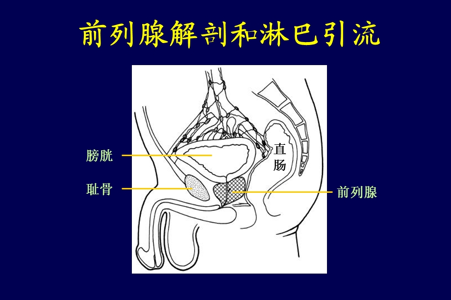 前列腺癌靶区勾画概要ppt课件.ppt_第3页