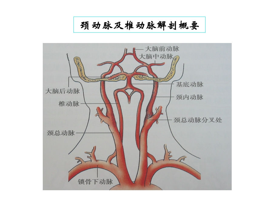 颈动脉及椎动脉超声诊断课件.ppt_第2页