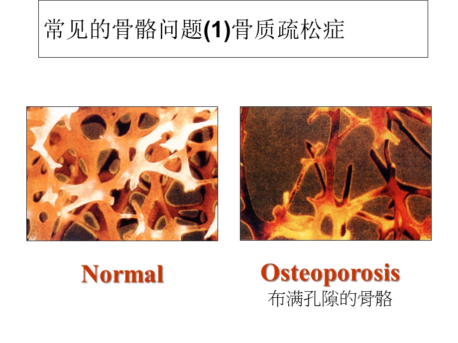 骨骼及眼睛保健课件.ppt_第2页