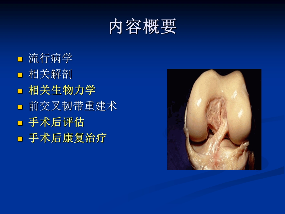 前交叉韧带重建术ppt课件.ppt_第2页