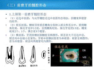 前磨牙及磨牙髓腔解剖ppt课件.ppt