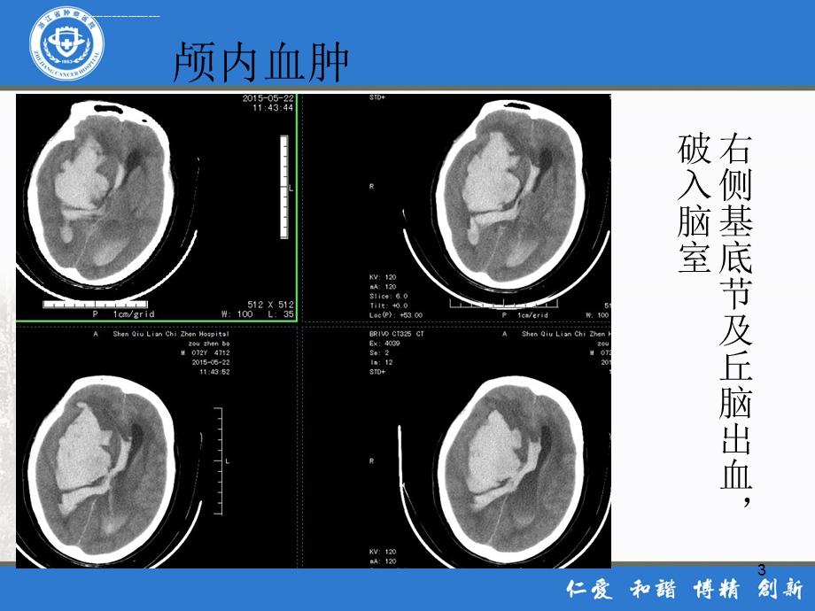 危急值 放射科ppt课件.ppt_第3页