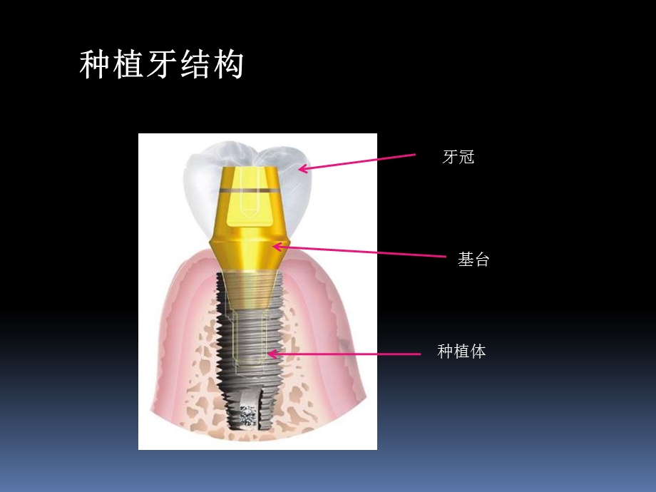 口腔专业知识培训ppt课件.pptx_第3页