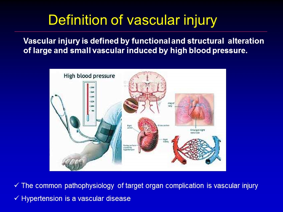 高血压与血管损伤 高平进课件.ppt_第2页