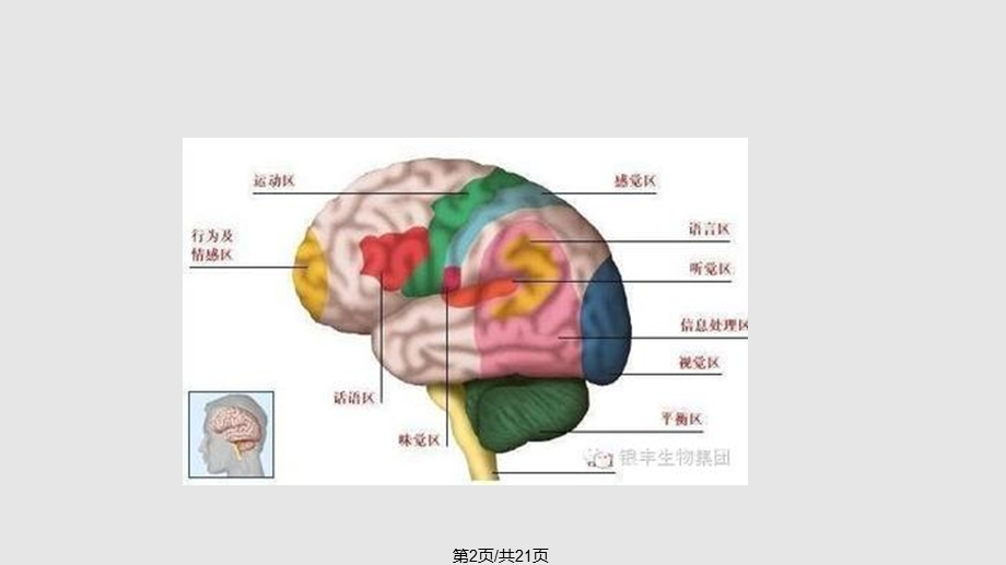 高血压脑出血的观察及护理要点课件.pptx_第2页