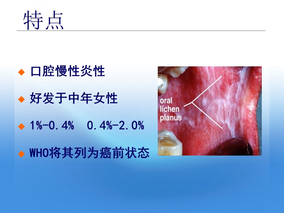 口腔扁平苔藓ppt课件.ppt_第2页