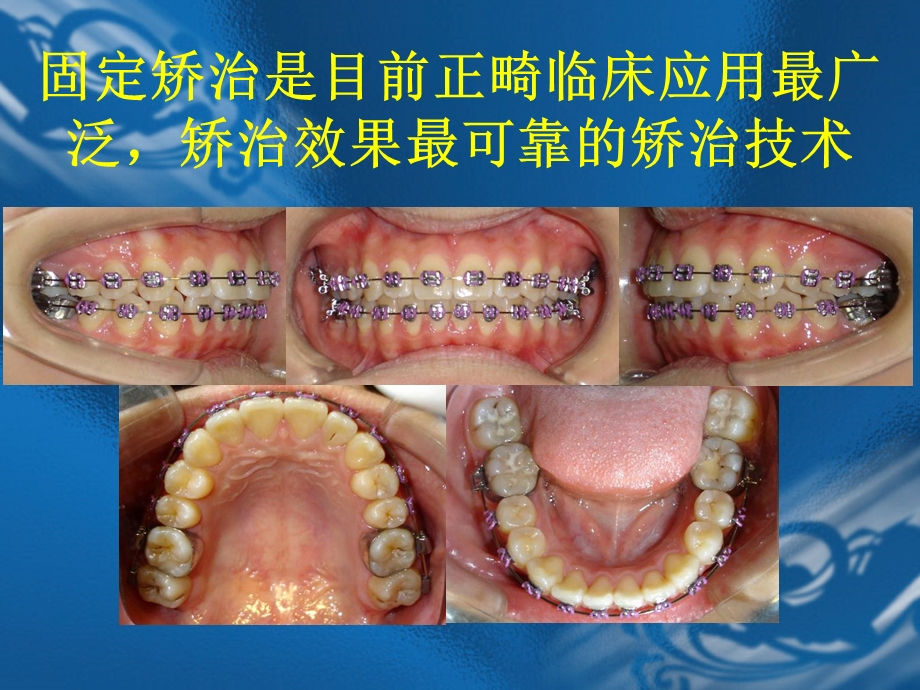 口腔正畸学ppt课件.ppt_第2页