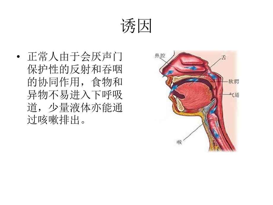 吸入性肺炎ppt课件.ppt_第3页