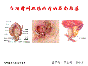 各期前列腺癌治疗的指南推荐ppt课件.ppt