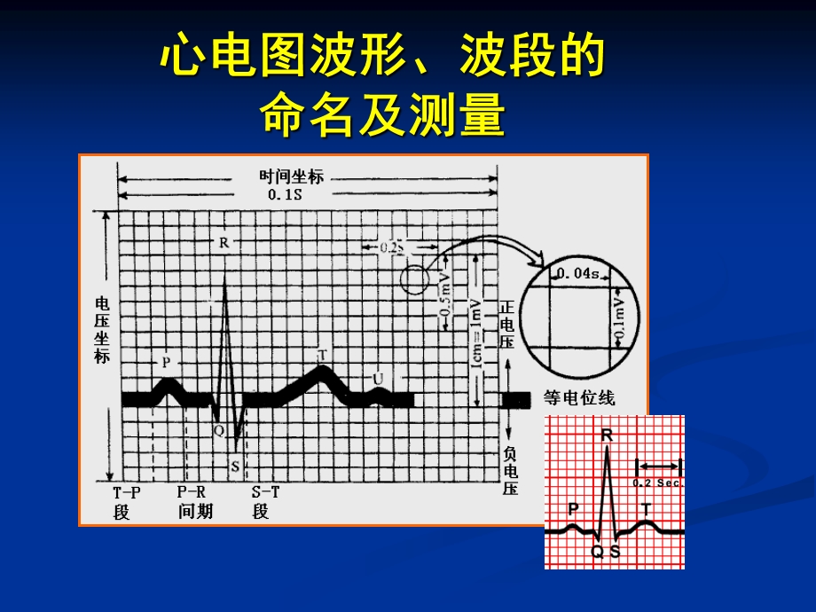 心电图 三基培训ppt课件.ppt_第3页