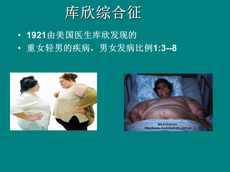 库欣综合征 ppt课件.ppt_第2页