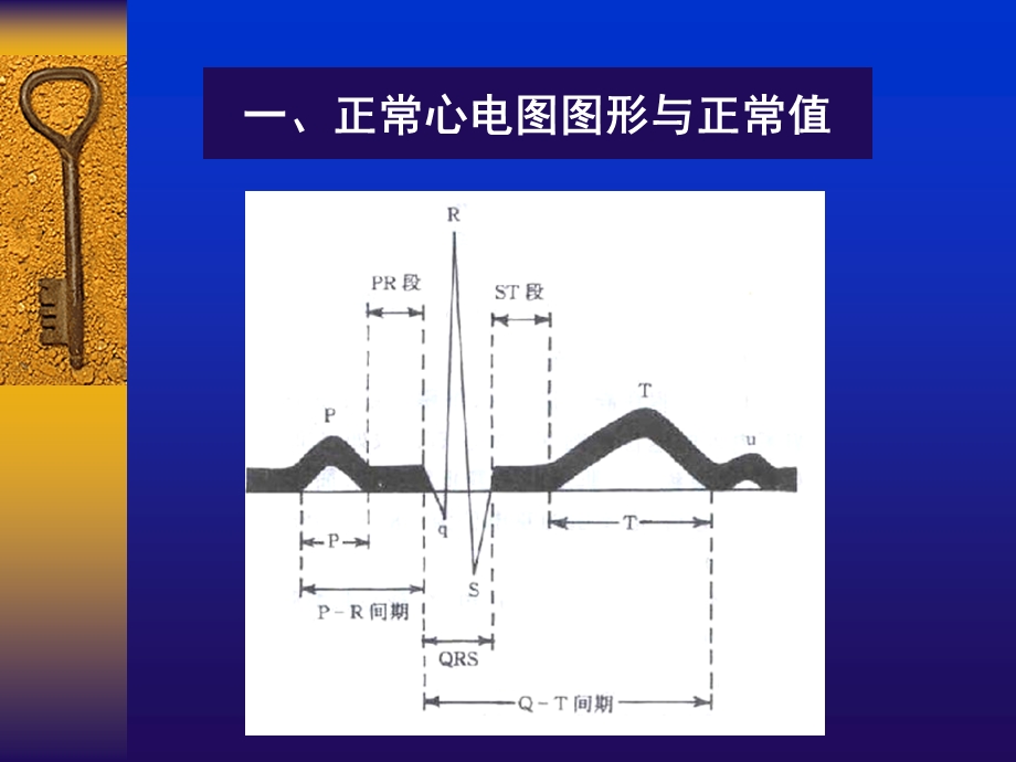 常见心电图鉴别和诊断ppt课件.ppt_第3页