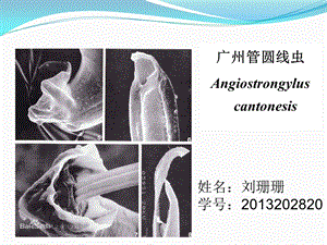 寄生虫ppt课件 广州管圆线虫讲解.ppt