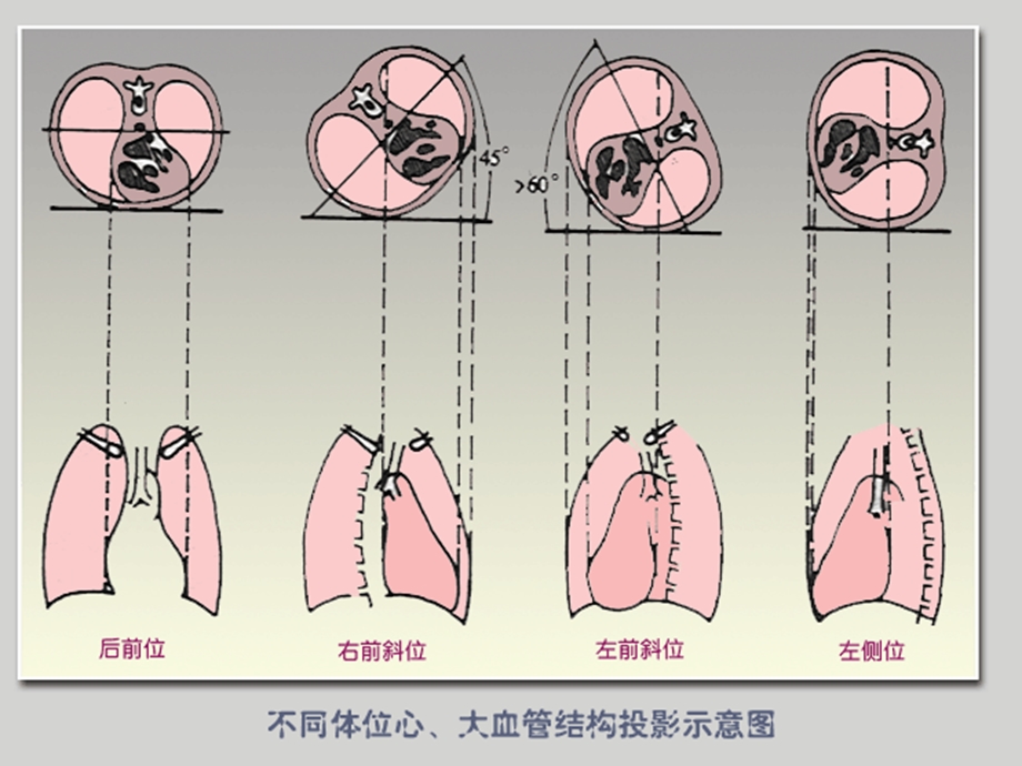 循环系统影像学表现(详细、全面)ppt课件.ppt_第3页