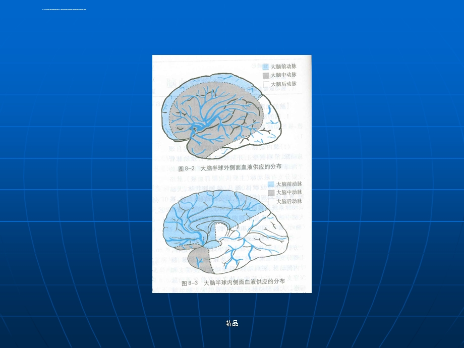 急性脑血管疾病培训ppt课件.ppt_第3页