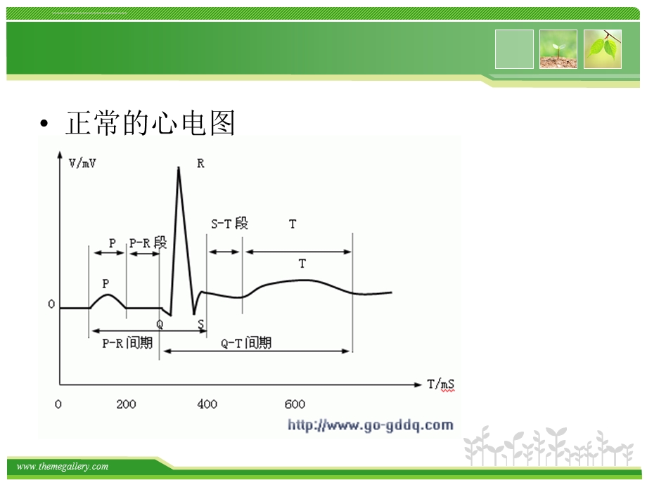 房颤的心电图诊断ppt课件.ppt_第3页