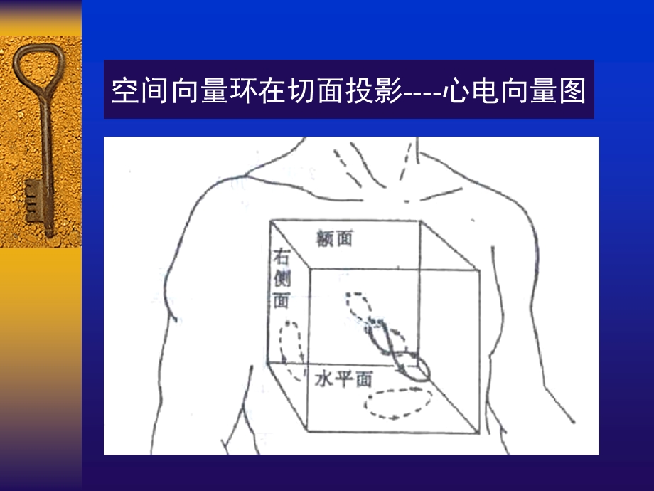 常见心电图诊断要点ppt课件.ppt_第2页