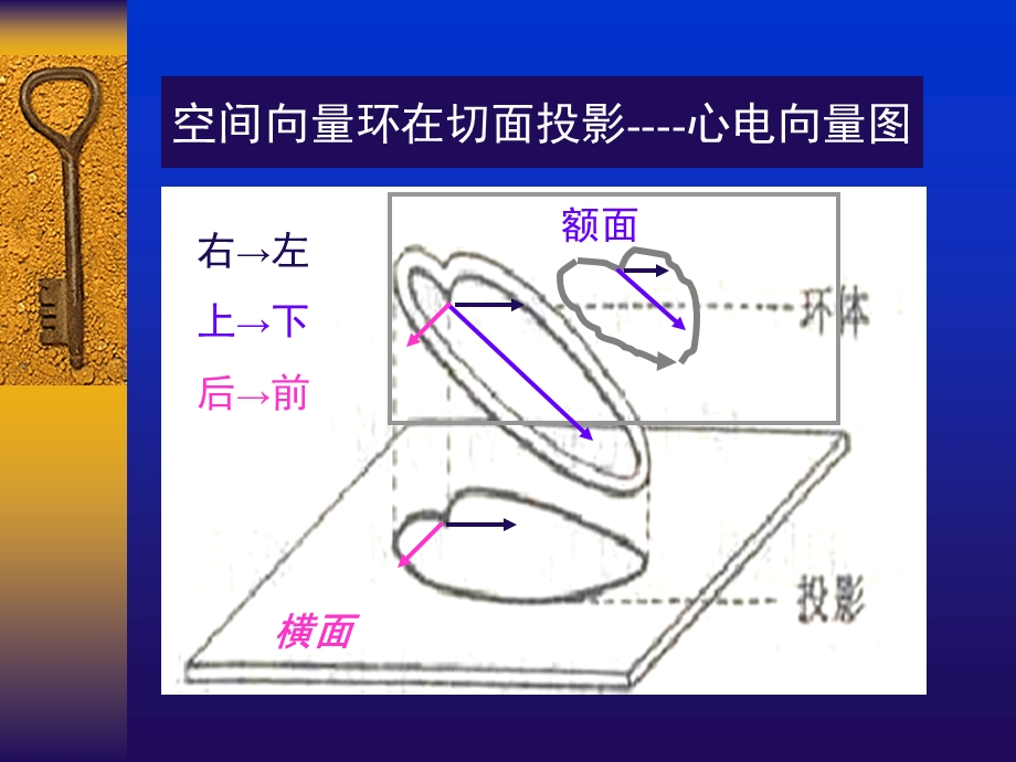 常见心电图诊断要点ppt课件.ppt_第3页