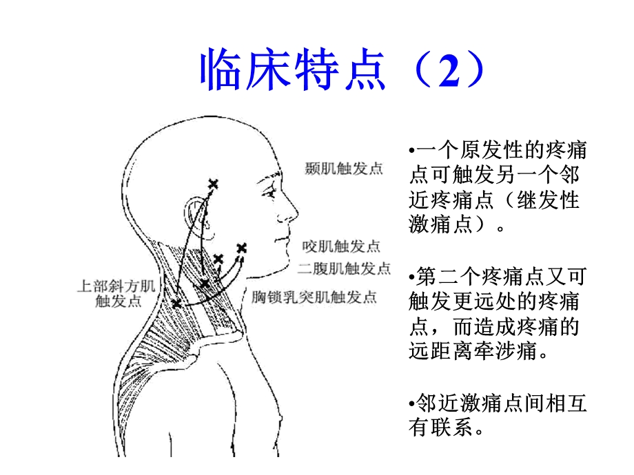 头痛激痛点ppt课件.ppt_第2页