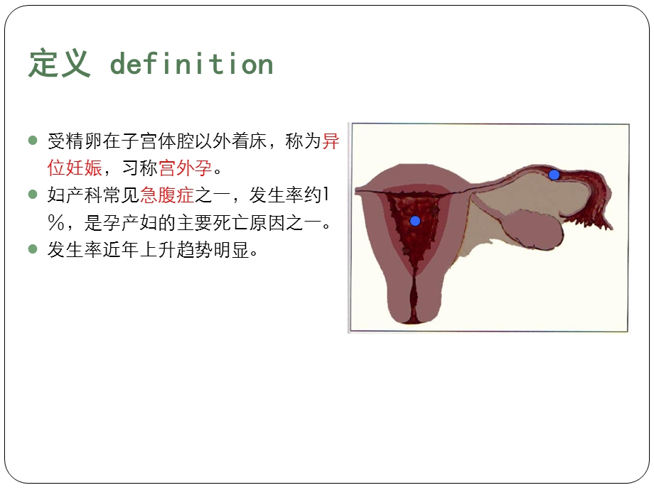 异位妊娠(PPT课件).pptx_第2页